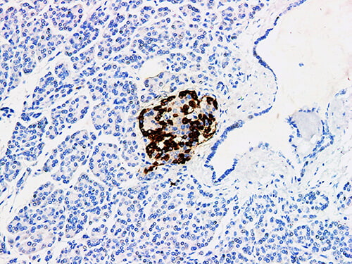 Glucagon Monoclonal Antibody (ELAB6062-M)