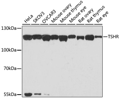 TSHR Polyclonal Antibody (E-AB-61361)
