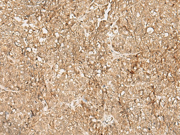 SNAPC5 Polyclonal Antibody (E-AB-18025)