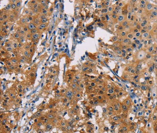 PDCD1LG2 Polyclonal Antibody (E-AB-14781)