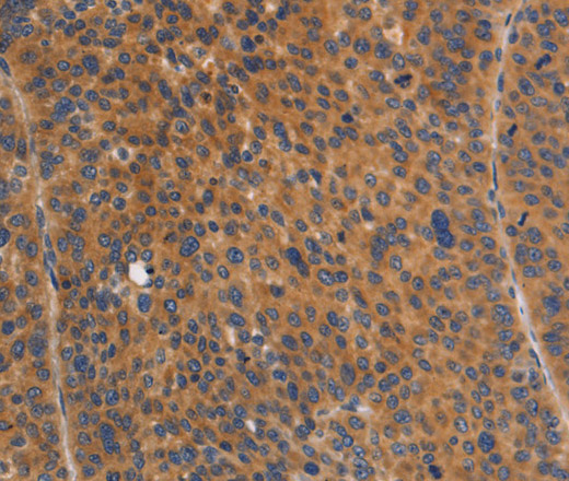 NOD1 Polyclonal Antibody (E-AB-16300)