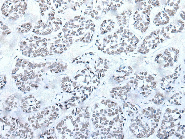 BRD3 Polyclonal Antibody (E-AB-53605)
