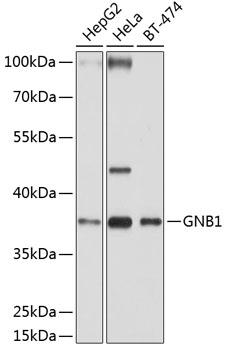 GNB1 Polyclonal Antibody (E-AB-62766)