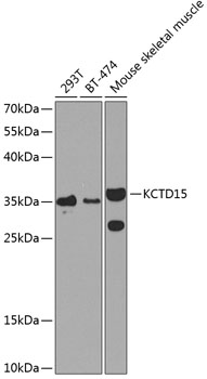 KCTD15 Polyclonal Antibody (E-AB-63173)