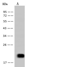 Recombinant IL-5 Monoclonal Antibody (AN300285P)