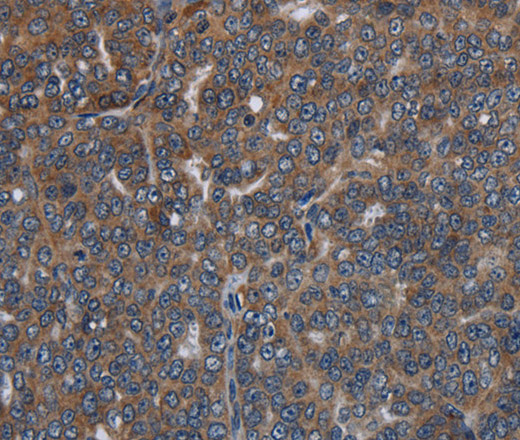 LETMD1 Polyclonal Antibody (E-AB-15090)