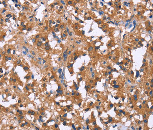 GPR172B Polyclonal Antibody (E-AB-16470)