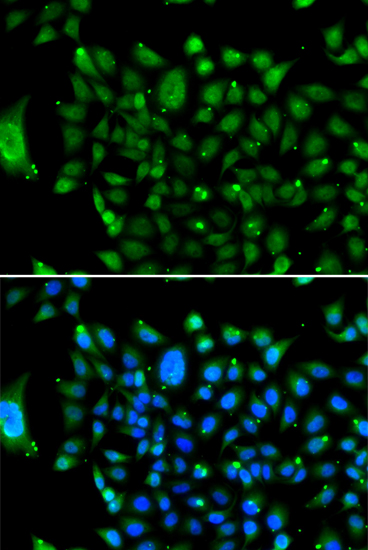 NCOR1 Polyclonal Antibody (E-AB-61490)