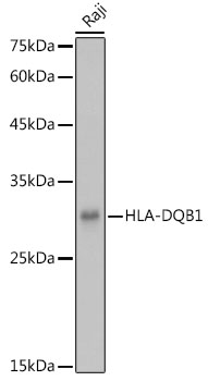 HLA-DQB1 Polyclonal Antibody (E-AB-92229)