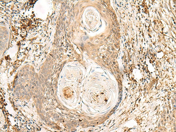 ZNF397 Polyclonal Antibody (E-AB-18814)
