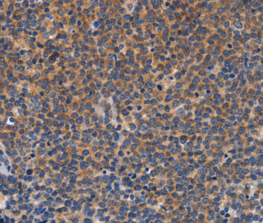 CCL23 Polyclonal Antibody (E-AB-16305)