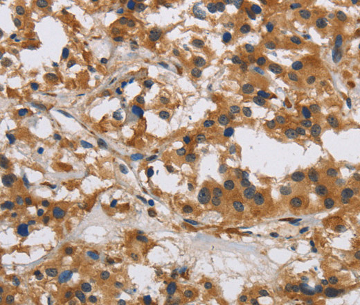 IL17RB Polyclonal Antibody (E-AB-13326)