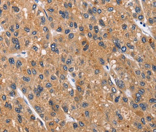 CEACAM3 Polyclonal Antibody (E-AB-13995)