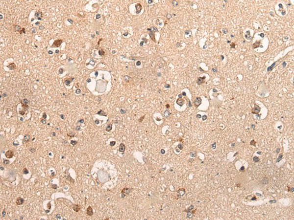 DYNAP Polyclonal Antibody (E-AB-19639)