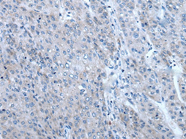 ZIC1 Polyclonal Antibody (E-AB-19554)