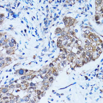 Caspase-3 Polyclonal Antibody (E-AB-63510)