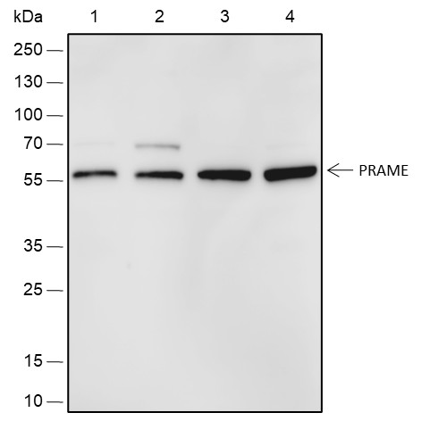 Recombinant PRAME Monoclonal Antibody (AN301801L)