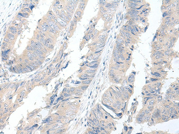 GBA2 Polyclonal Antibody (E-AB-52669)