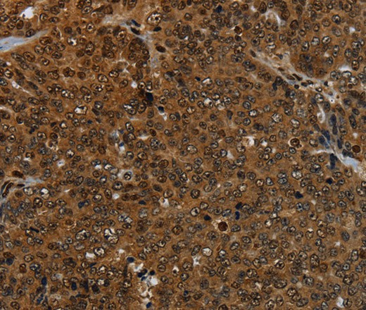 KDM4B Polyclonal Antibody (E-AB-16691)