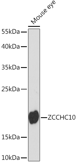 ZCCHC10 Polyclonal Antibody (E-AB-91571)
