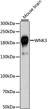 WNK3 Polyclonal Antibody (E-AB-66487)