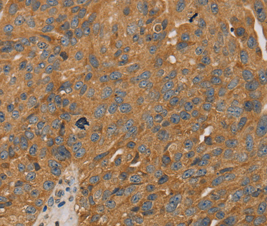 PARP11 Polyclonal Antibody (E-AB-11474)