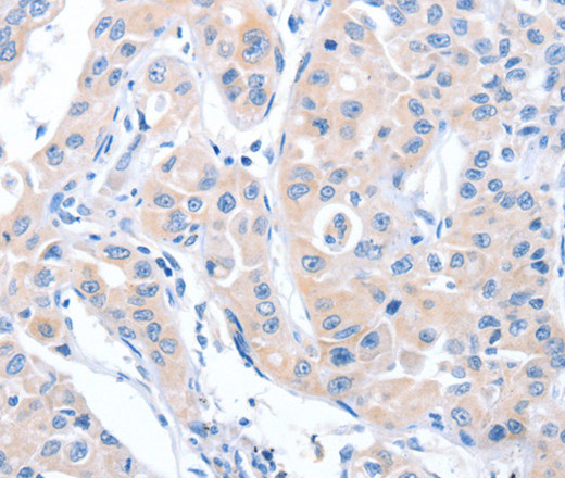 ARHGEF6 Polyclonal Antibody (E-AB-16170)