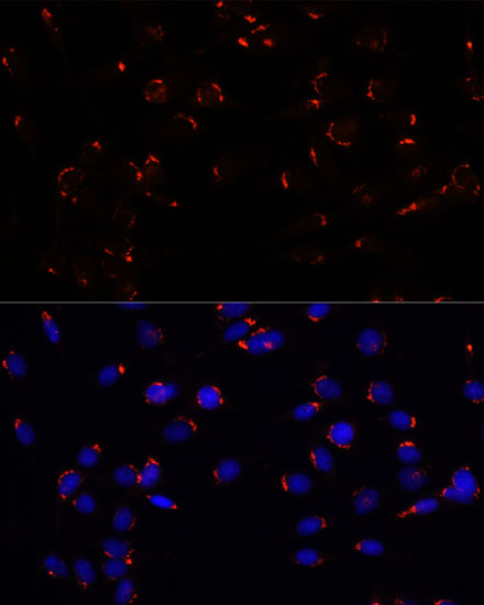 GOLGA5 Polyclonal Antibody (E-AB-66564)