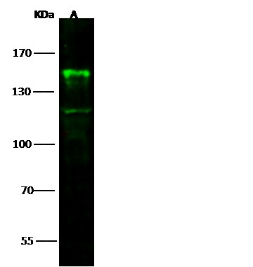 Recombinant CD22 Monoclonal Antibody (AN300574P)