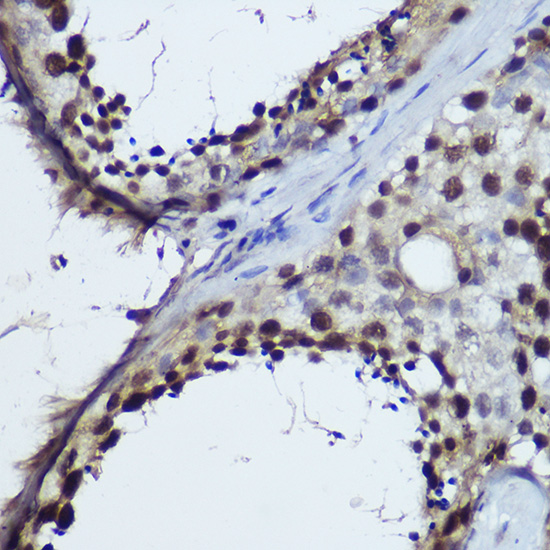 TET1 Polyclonal Antibody (E-AB-93259)