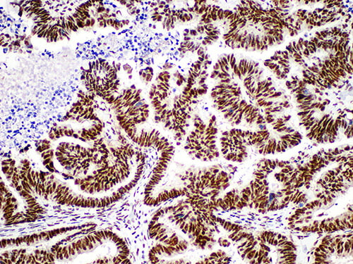 Factor XIIIa Monoclonal Antibody (ELAB6055-M)