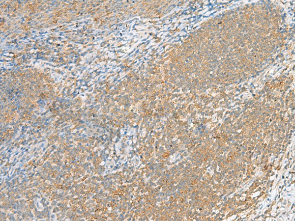 FOLR1 Polyclonal Antibody (E-AB-19878)