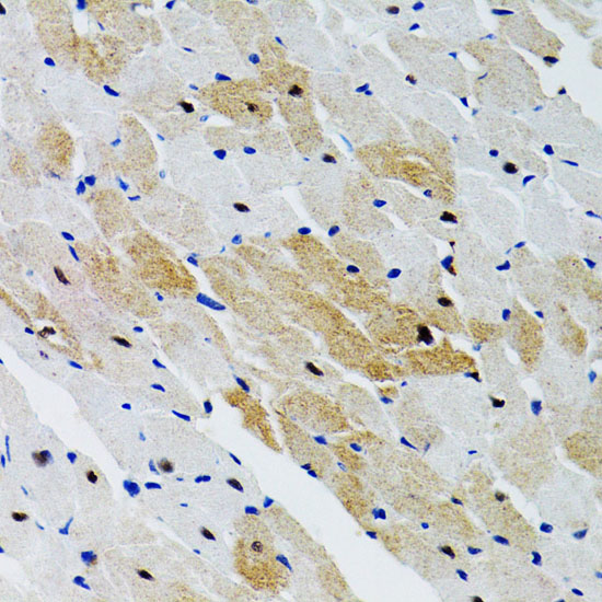 PTPN11 Polyclonal Antibody (E-AB-60785)