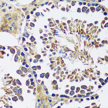 CCDC124 Polyclonal Antibody (E-AB-65005)