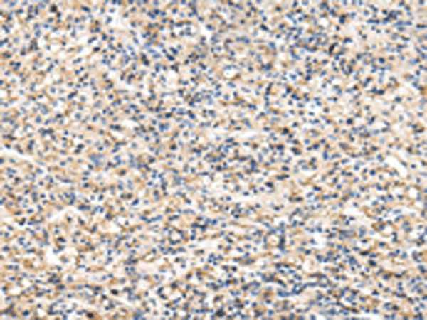 VCAM1 Polyclonal Antibody (E-AB-18302)