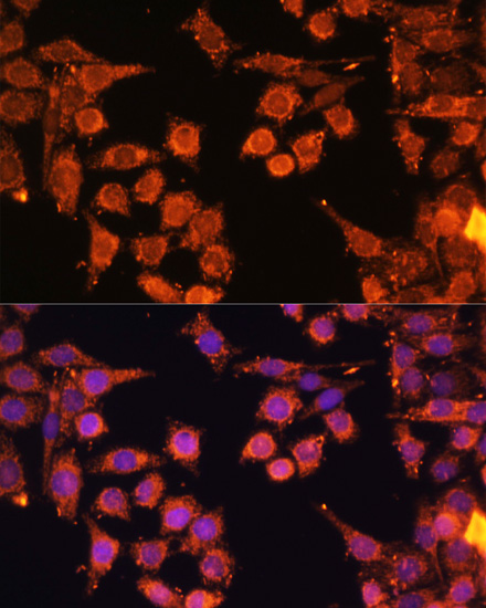 PRKAA1/PRKAA2 Polyclonal Antibody (E-AB-67096)