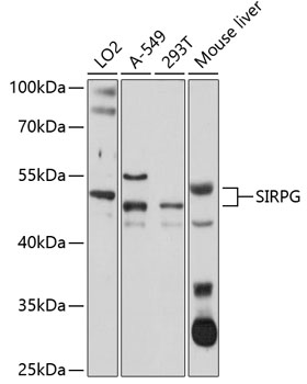 SIRPG Polyclonal Antibody (E-AB-92613)