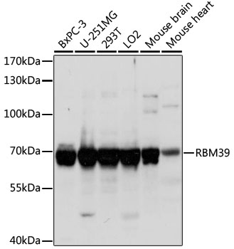 RBM39 Polyclonal Antibody (E-AB-66563)