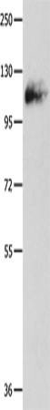 Amphiphysin I Polyclonal Antibody (E-AB-13895)