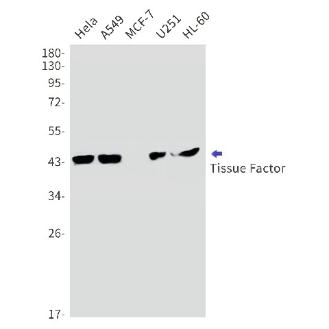 Recombinant Tissue Factor Monoclonal Antibody (E-AB-81613)