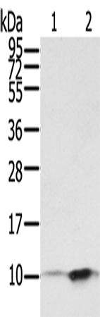 S100P Polyclonal Antibody (E-AB-15373)
