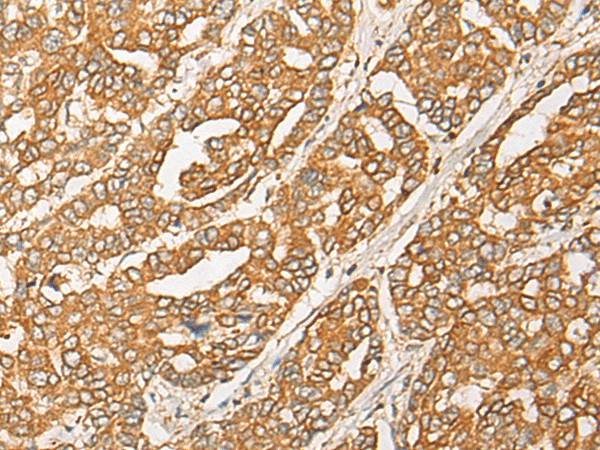 GNB1L Polyclonal Antibody (E-AB-17869)