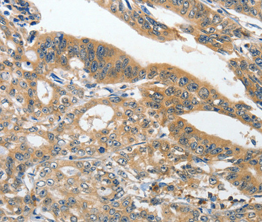 ANKZF1 Polyclonal Antibody (E-AB-16160)