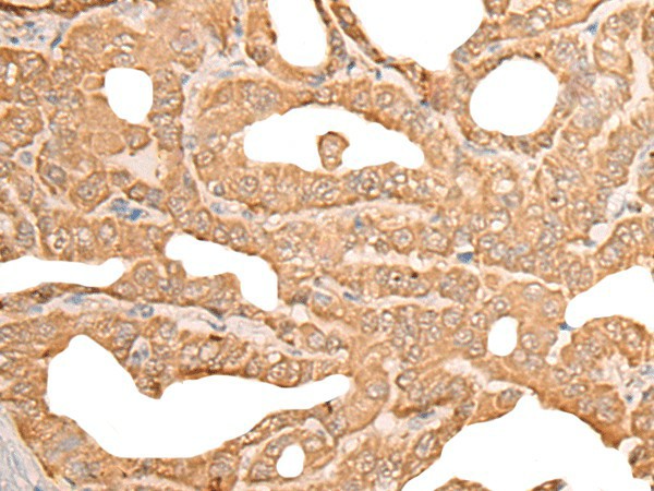 CUTA Polyclonal Antibody (E-AB-52563)