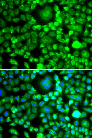 BLID Polyclonal Antibody (E-AB-61612)