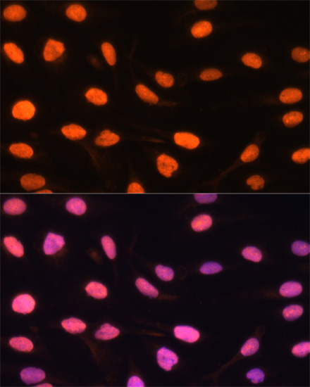 ZBED1 Polyclonal Antibody (E-AB-65540)