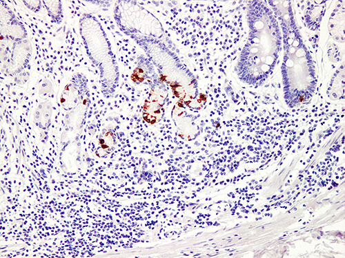 Gastrin Monoclonal Antibody (ELAB6181-M)