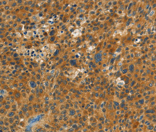 NPAP1 Polyclonal Antibody (E-AB-13029)