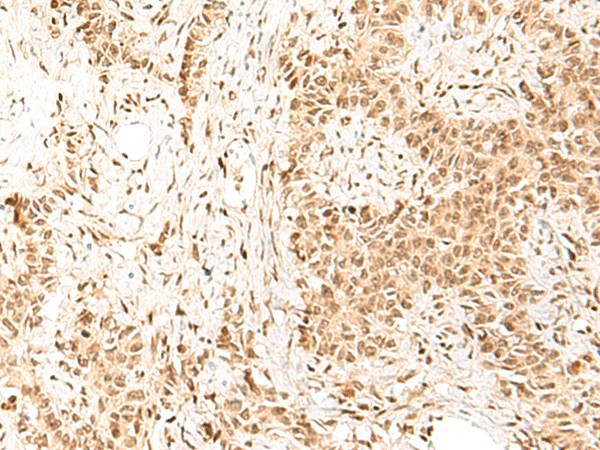 HIST1H1D Polyclonal Antibody (E-AB-18080)