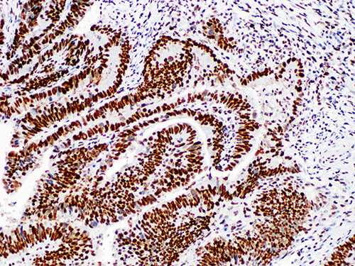 MSH2 Monoclonal Antibody (ELAB6750-M)